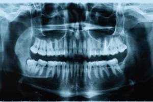 Ortopantomografía Odontología