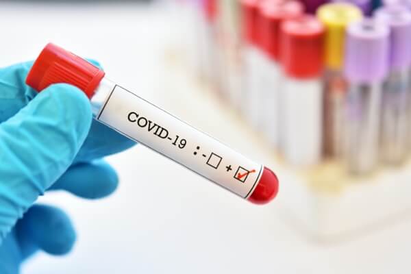 Test de inmunidad coronavirus. Serología IGM, IGG