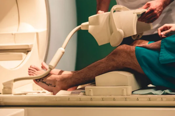 Resonancia magnética de rodilla