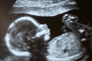 Revisión embarazo (consulta de obstetricia + ecografía obstétrica)