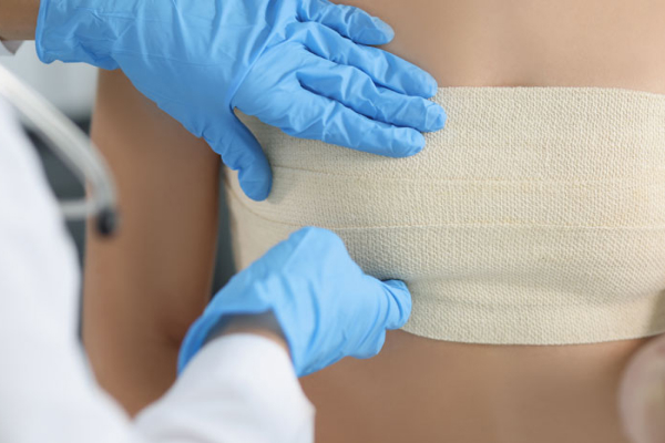 Cura post-operatoria de Cirugía General