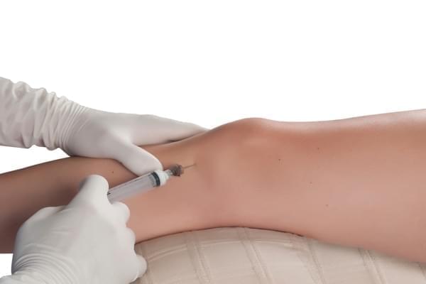 Artrocentesis de 1 Articulación (Traumatología)