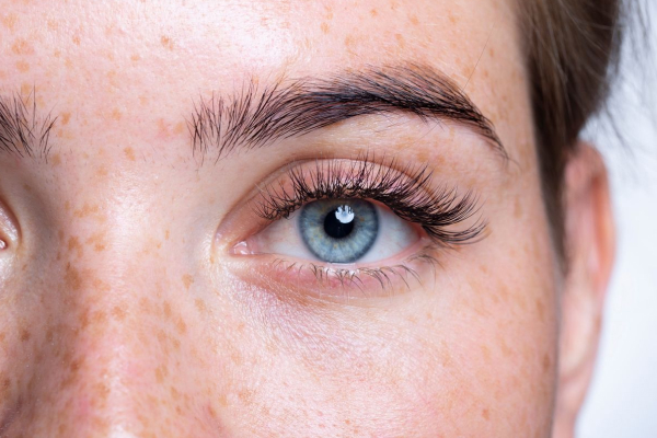 Dilatación de Puntos Lagrimales y Exploración de Vías Lagrimales