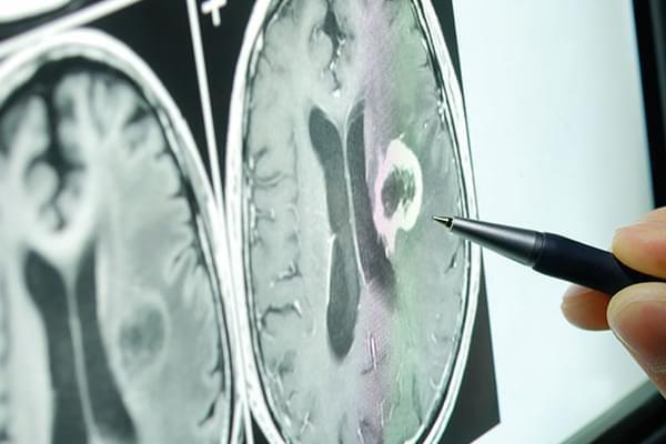 Eco Doppler Cerebral