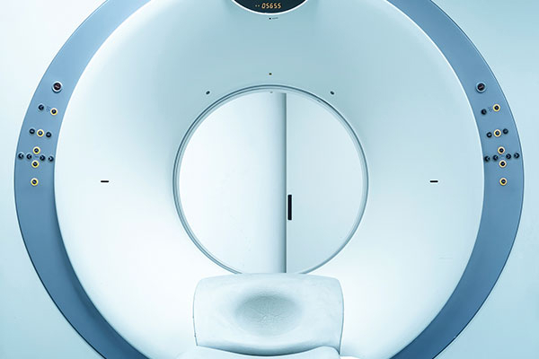 Tomografía de Craneo