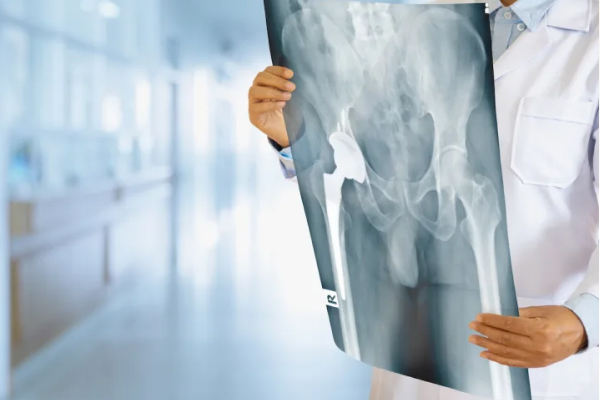 Rx Pelvis AP Lateral