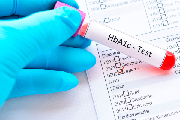 Hemoglobina Glicosilada (HBA1C)